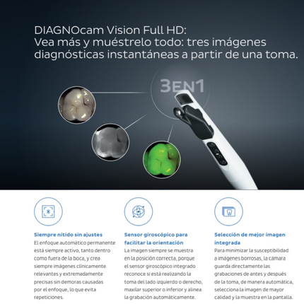 Camara Intraoral DIAGNOcam Vision Full HD