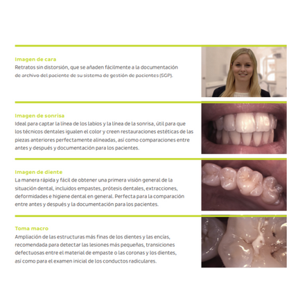 Camara Intraoral DIAGNOcam Vision Full HD