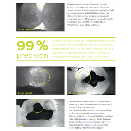 Camara Intraoral DIAGNOcam Vision Full HD