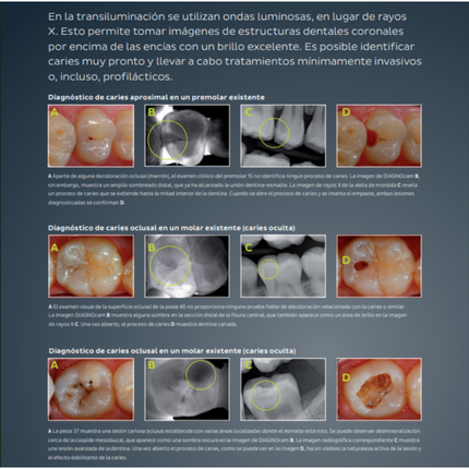 Camara Intraoral DIAGNOcam Vision Full HD